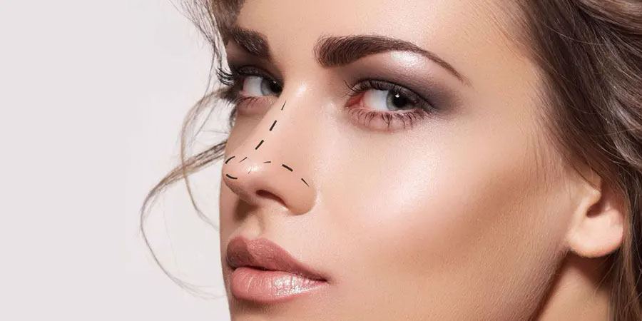 You are currently viewing Thinking about a Nose Job? Here’s everything you need to know